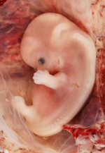 Foetus.png