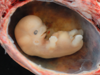 Embryo3.png